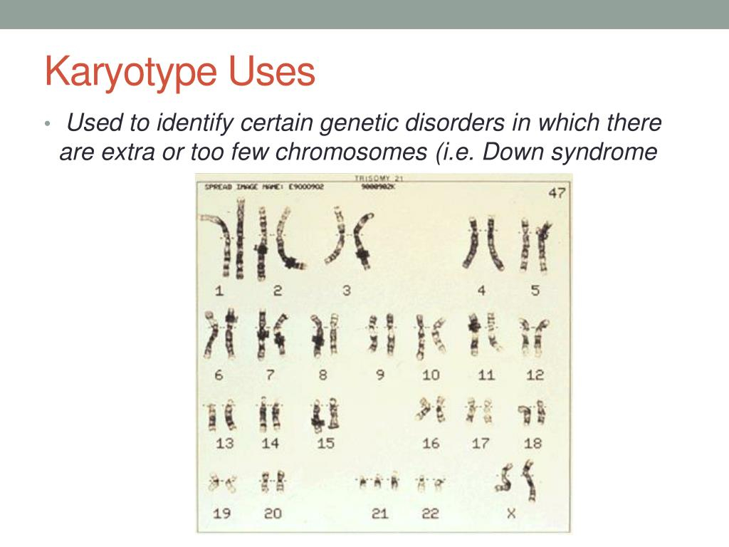 Alzheimer 39 S Pedigree Chart Chartdevelopment