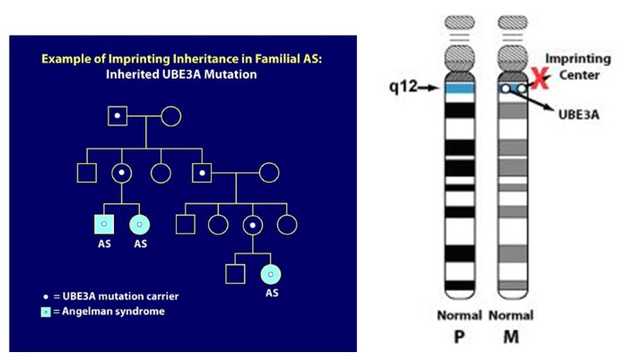 Angelman Syndrome Pedigree Chart