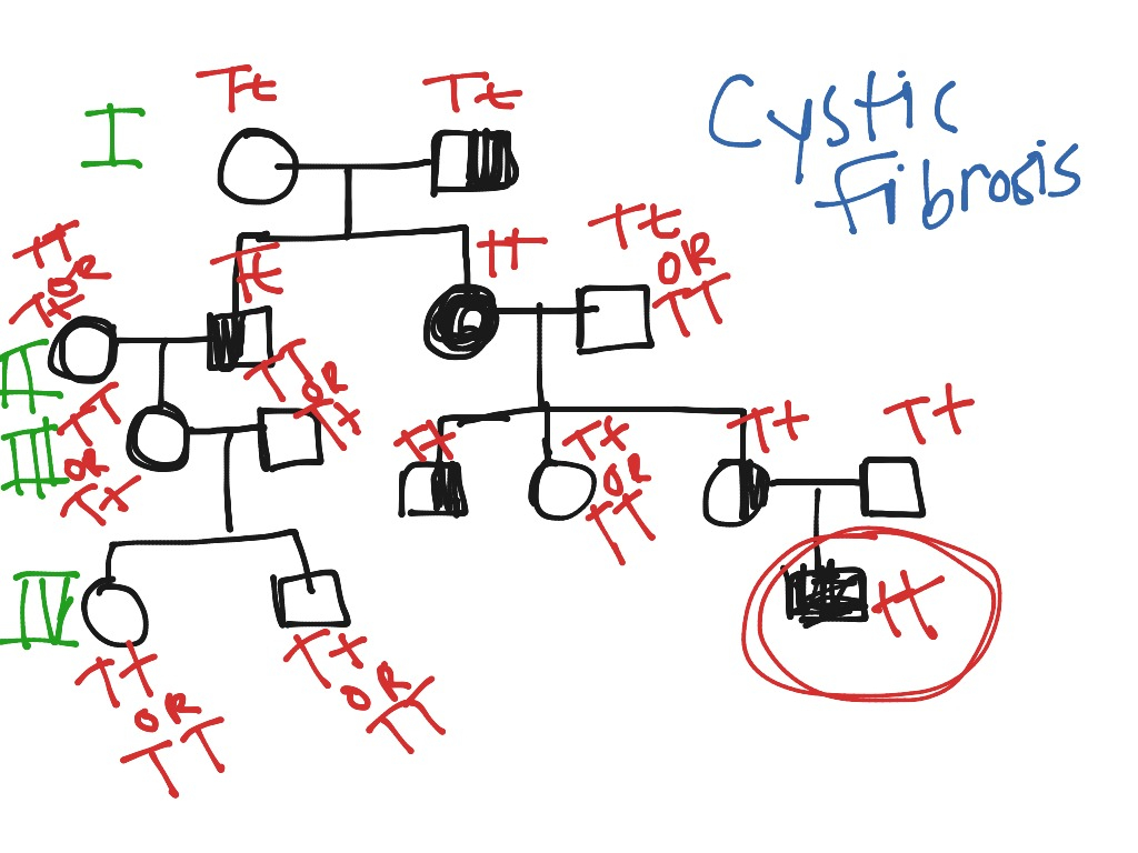 Cystic Fibrosis Pedigree Chart A Visual Reference Of Charts Chart Master