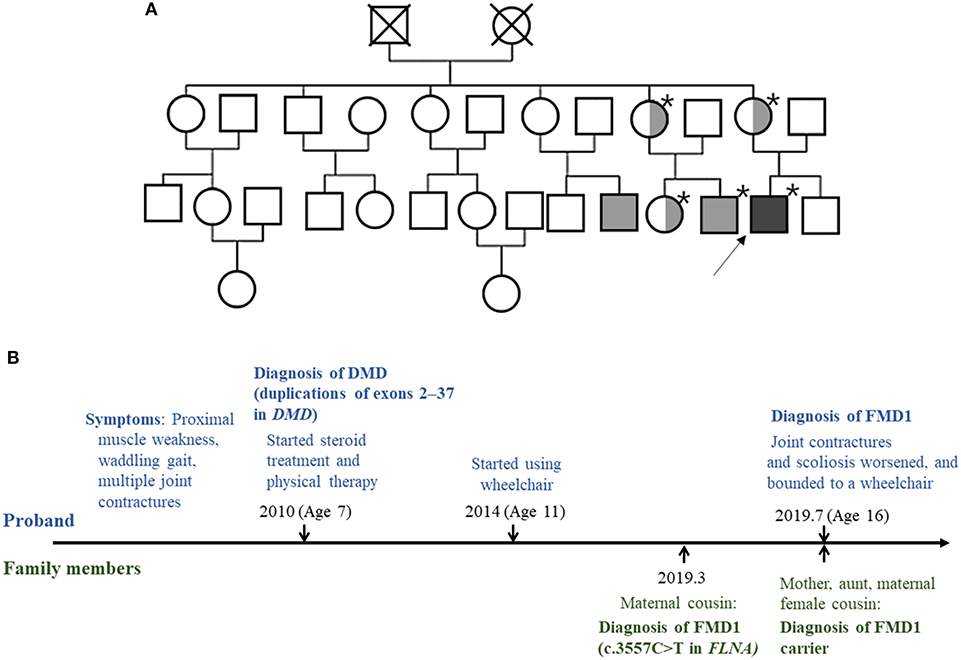 Duchenne Muscular Dystrophy Pedigree Chart