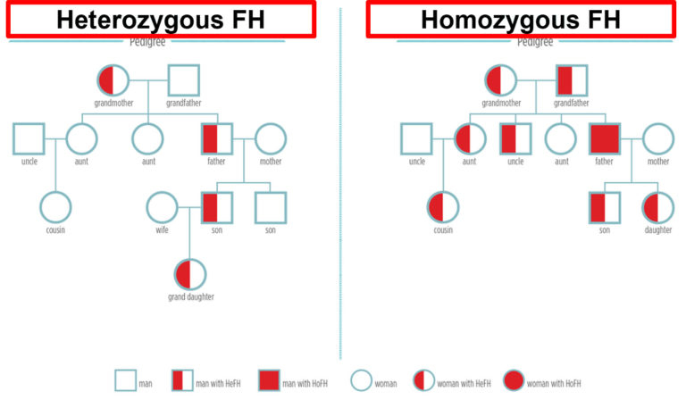 Familial Hypercholesterolemia Causes Genetics Symptoms Treatment