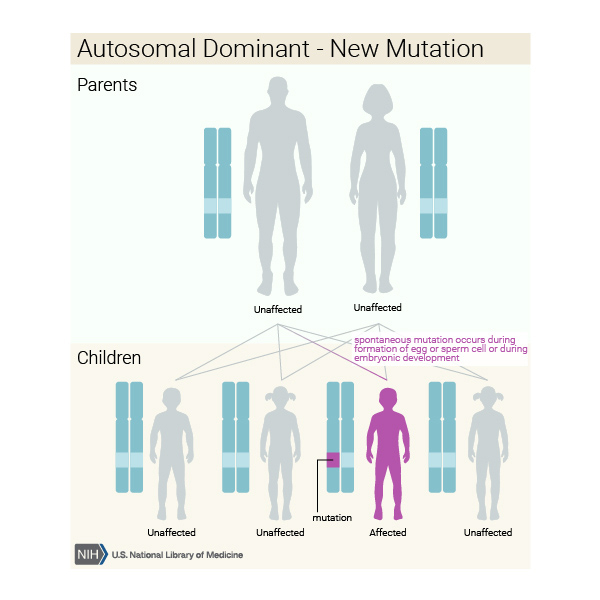 Marfan Syndrome MedlinePlus Genetics