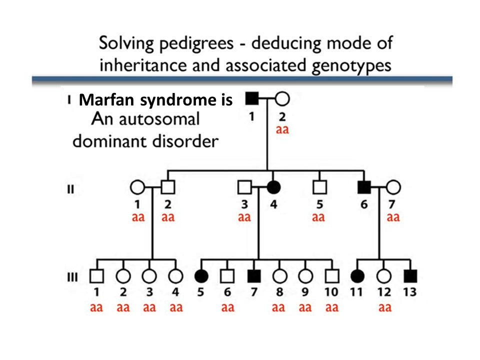 Marfan Syndrome Pedigree Chart A Visual Reference Of Charts Chart Master