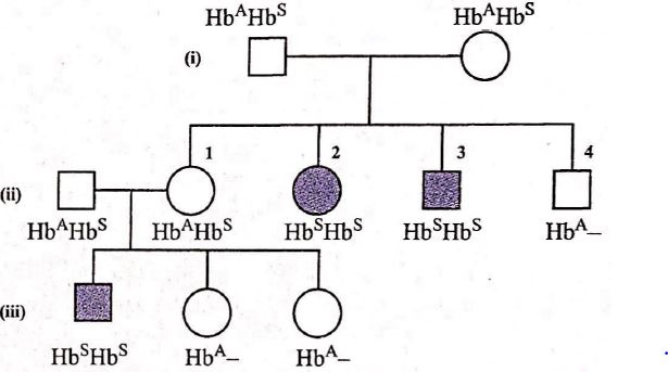 Study The Given Pedigree Chart For Sickle cell Anaemia And Select The 