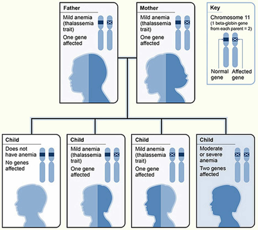 Thalassemia Symptoms Causes Types Diagnosis Test And Treatment
