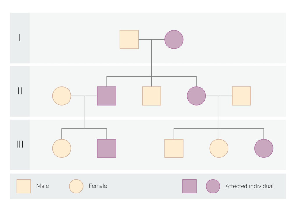 Turner Syndrome Pedigree Chart