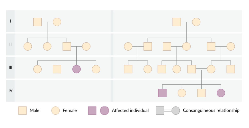 Turner Syndrome Pedigree Chart
