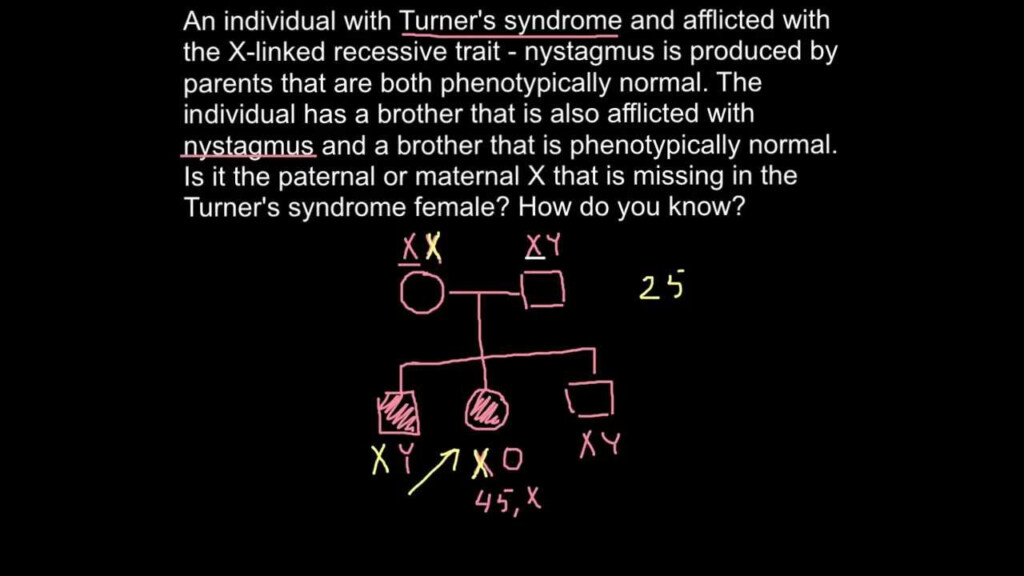 Turner Syndrome Pedigree Chart Keski